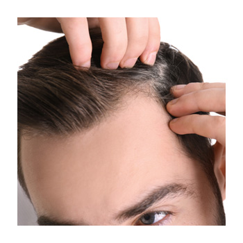 Image of person inspecting their hairline